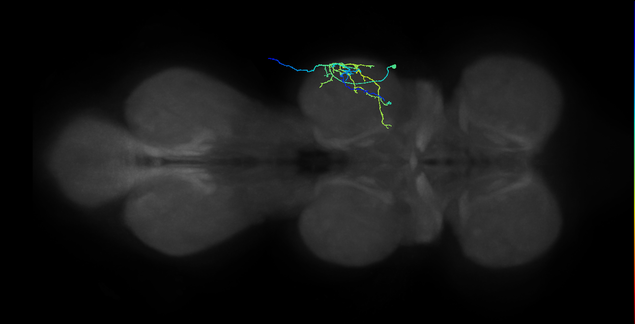metathoracic femoral reductor muscle motor neuron