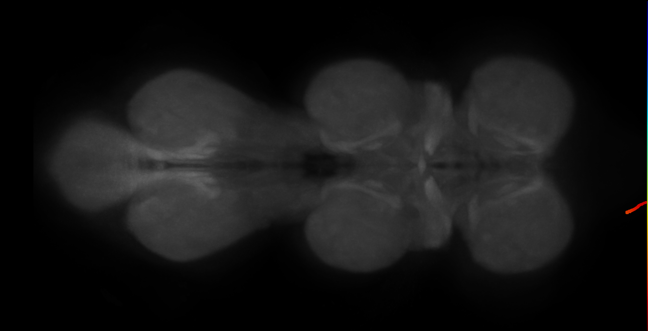 adult motor neuron