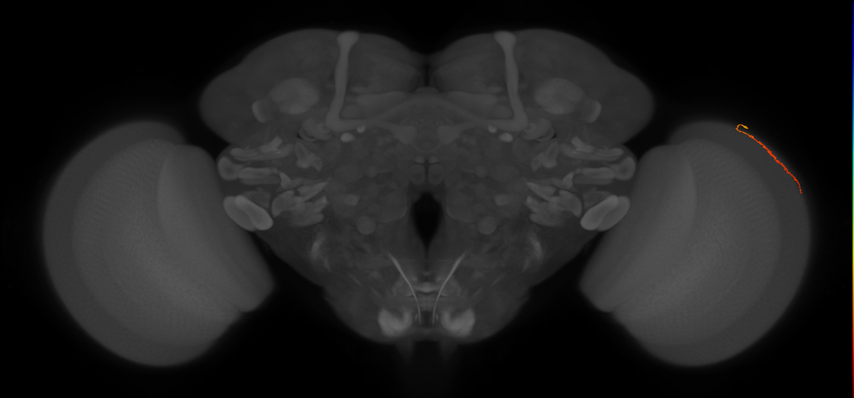 Dm3a_R (MaleCNS:148644)