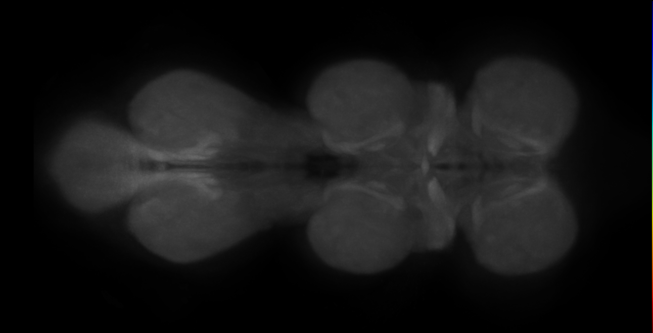 adult lateral fan-shaped body tangential neuron