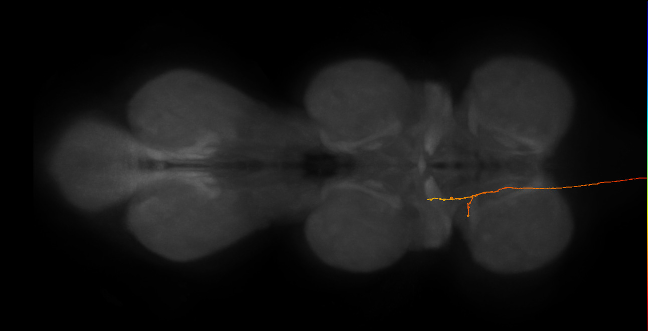 DNge085_R (MaleCNS:33876)