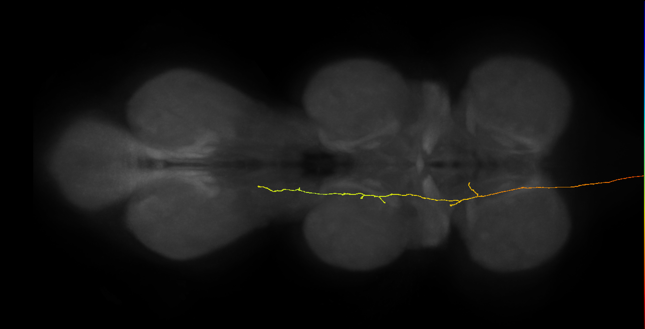 DNge089_R (MaleCNS:38848)