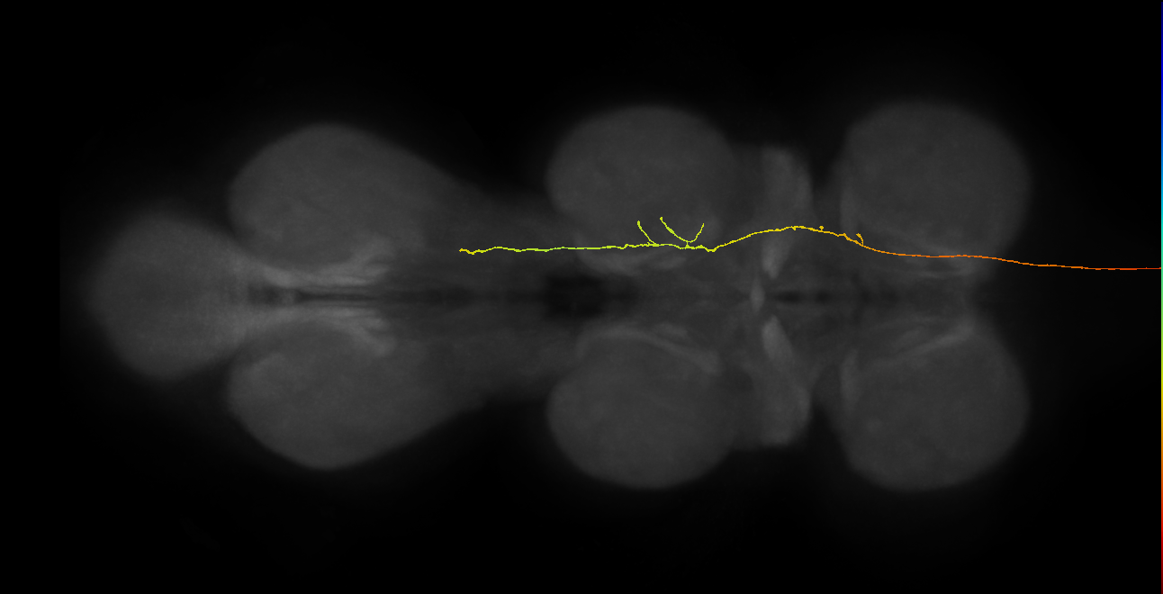 DNge089_L (MaleCNS:38465)
