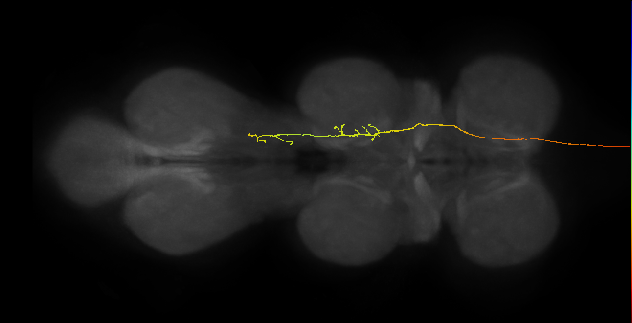DNge091_L (MaleCNS:24657)