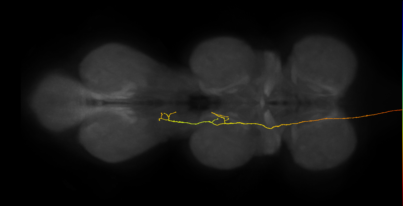 DNge091_R (MaleCNS:16257)
