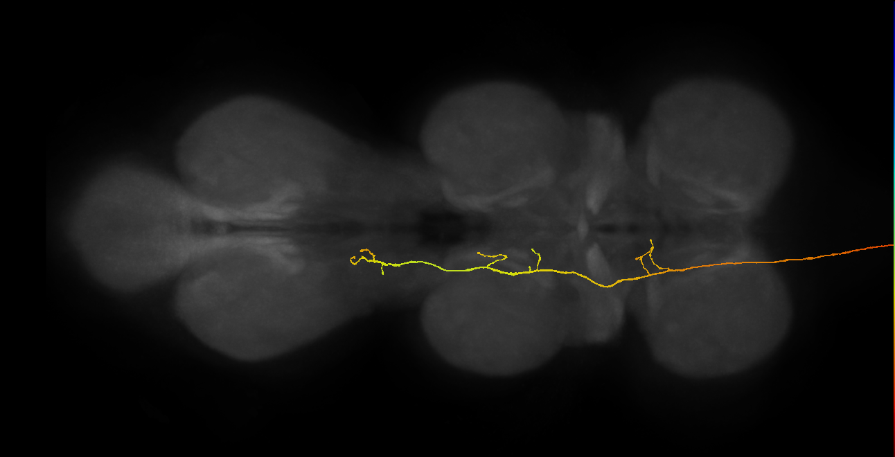DNge091_R (MaleCNS:525812)