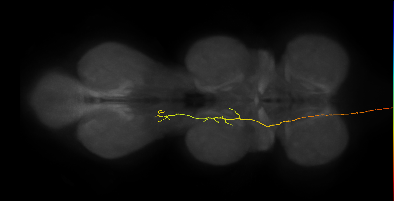 DNge091_R (MaleCNS:15509)