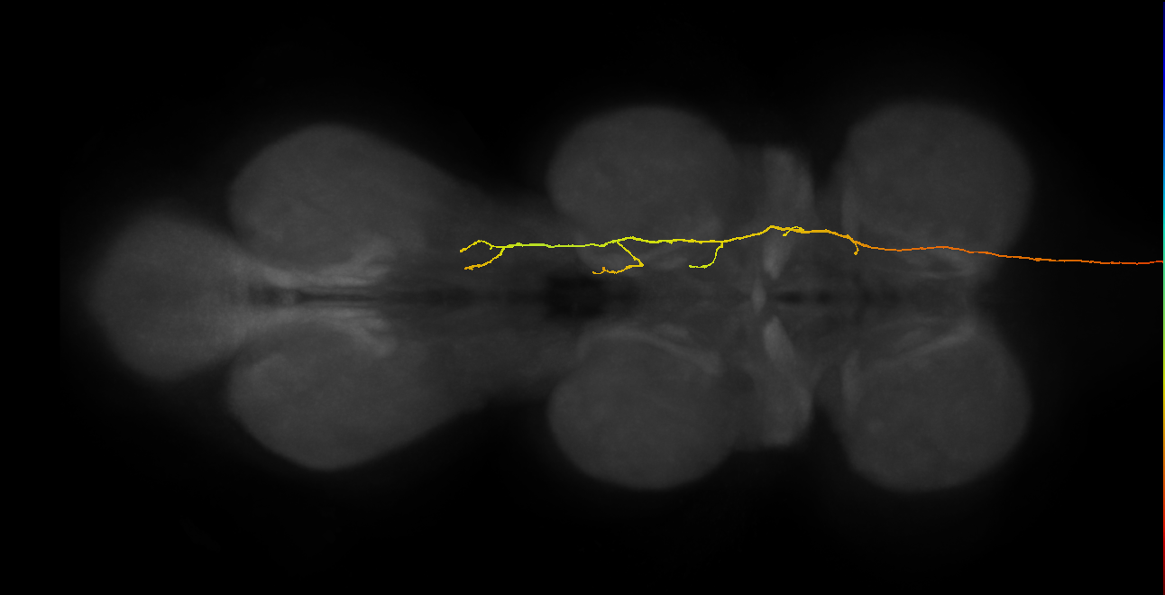 DNge091_L (MaleCNS:25634)