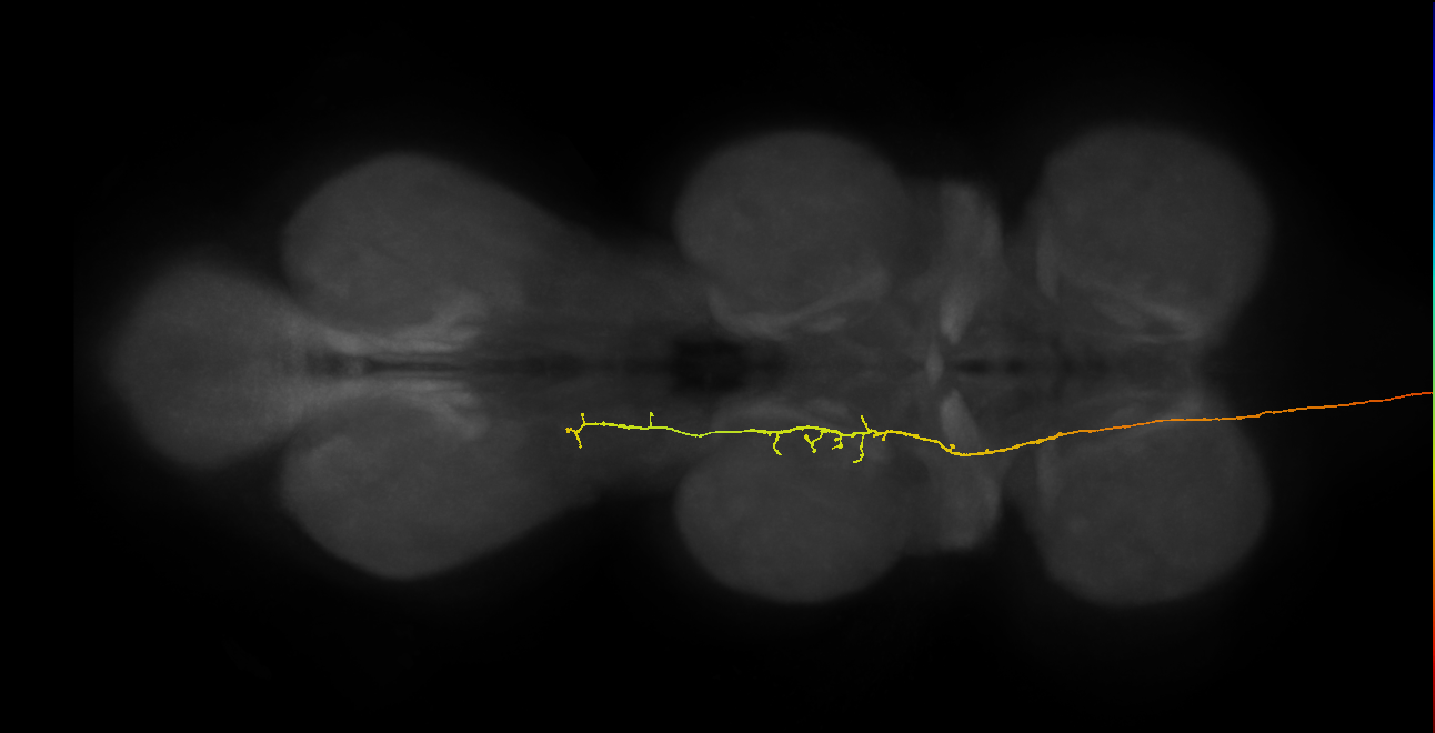 DNge091_R (MaleCNS:23953)