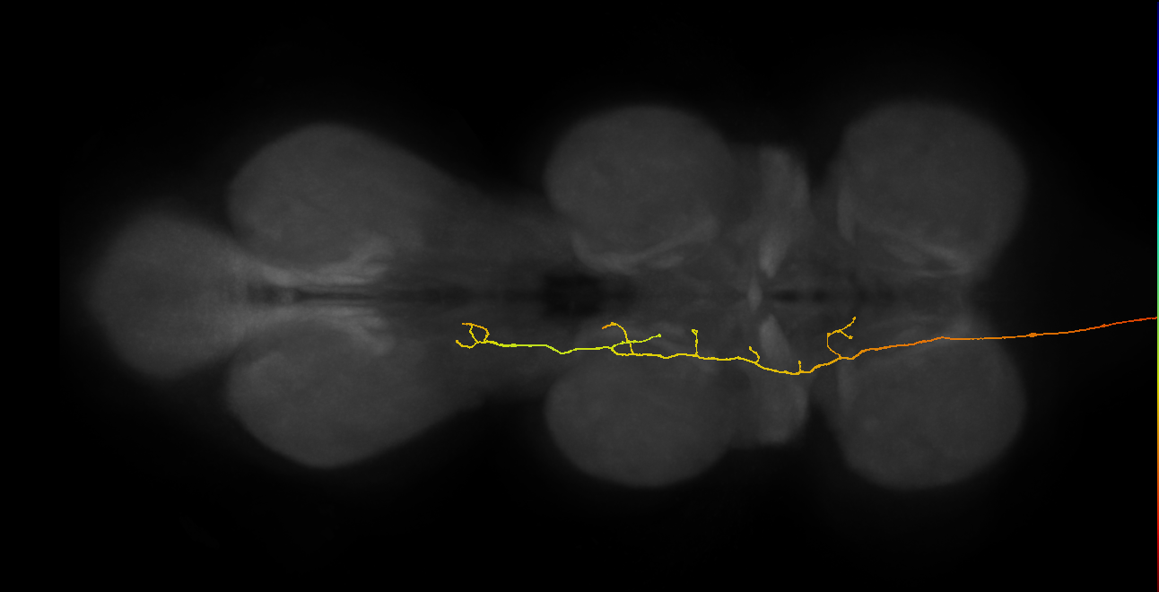 DNge091_R (MaleCNS:21428)