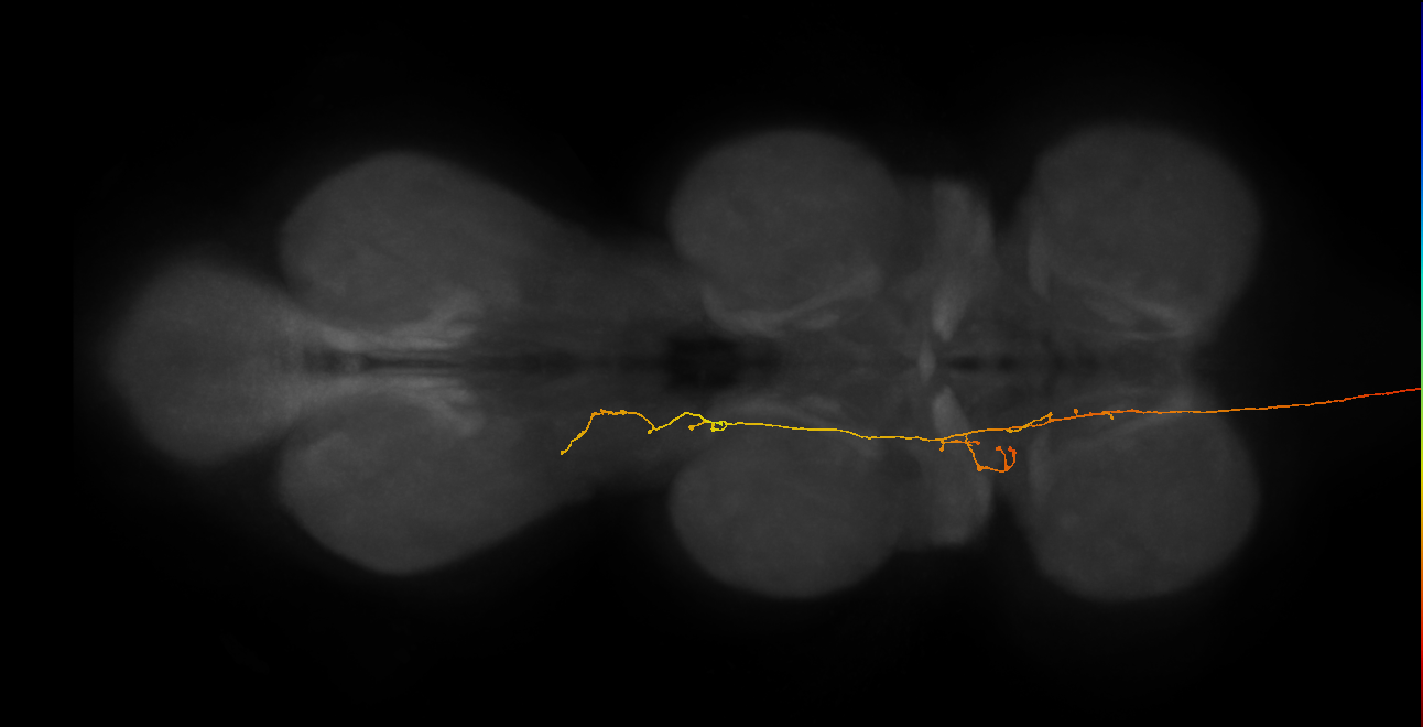 DNge092_R (MaleCNS:25802)