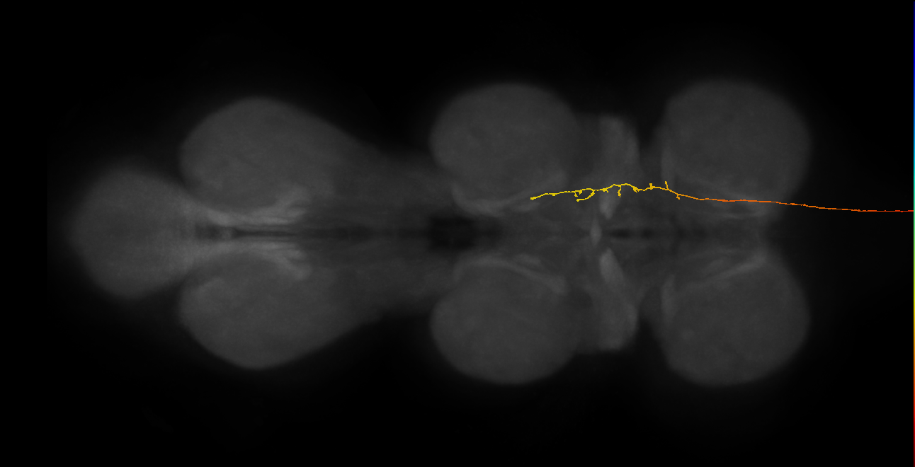 DNge094_L (MaleCNS:26743)