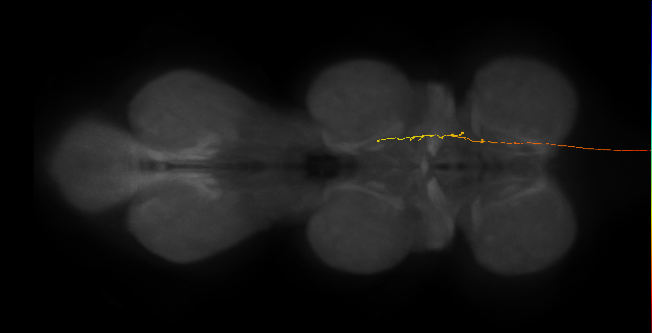 DNge094_L (MaleCNS:28001)