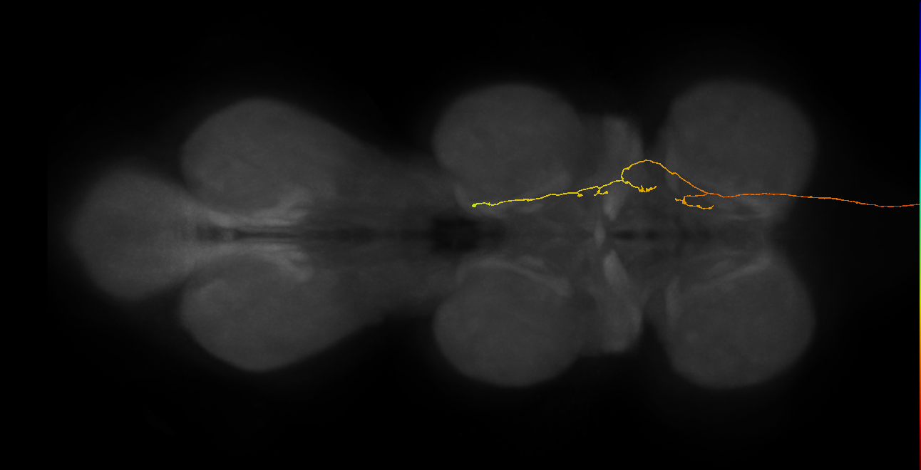 DNge094_L (MaleCNS:39071)