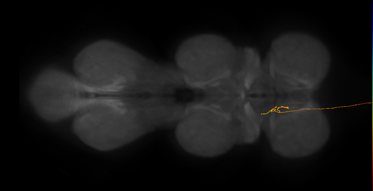 DNge094_R (MaleCNS:351504)