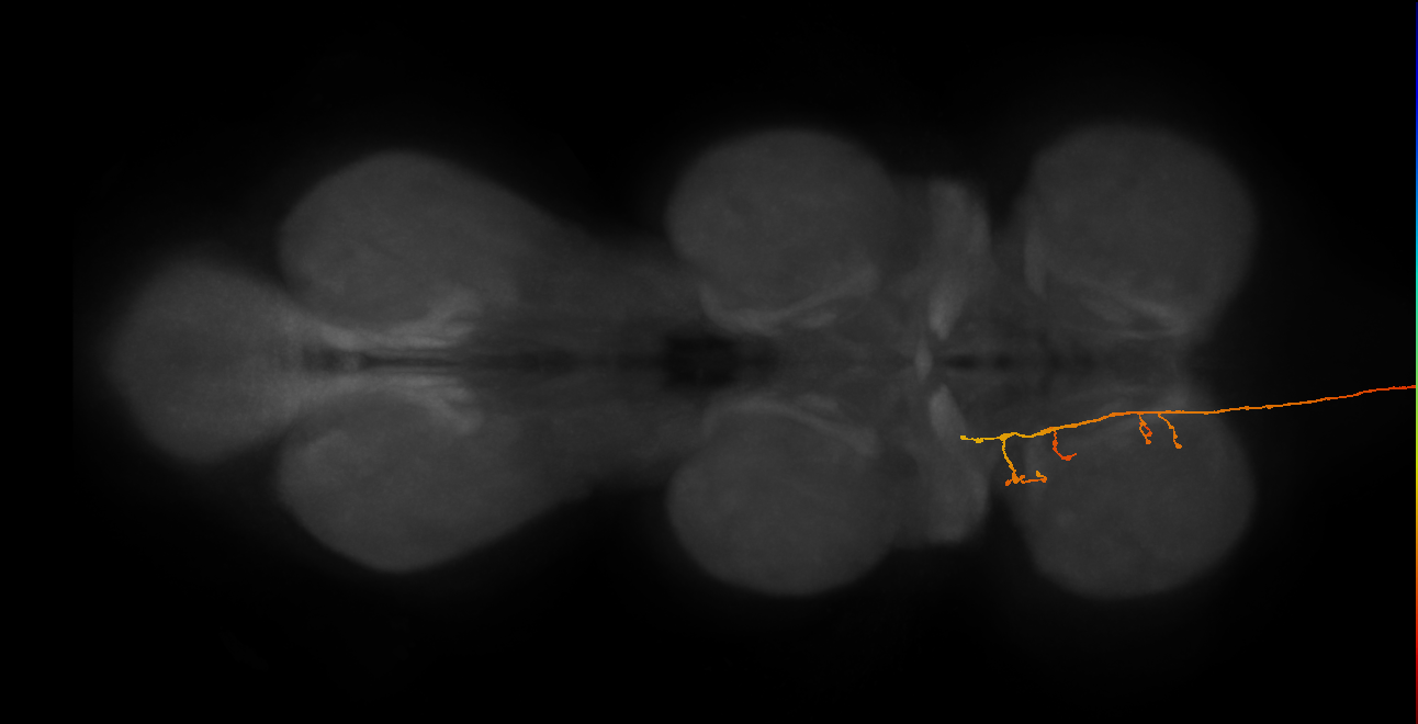 DNge113_R (MaleCNS:12687)