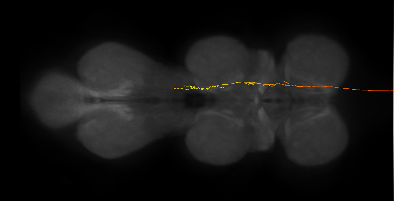DNge114_L (MaleCNS:31609)