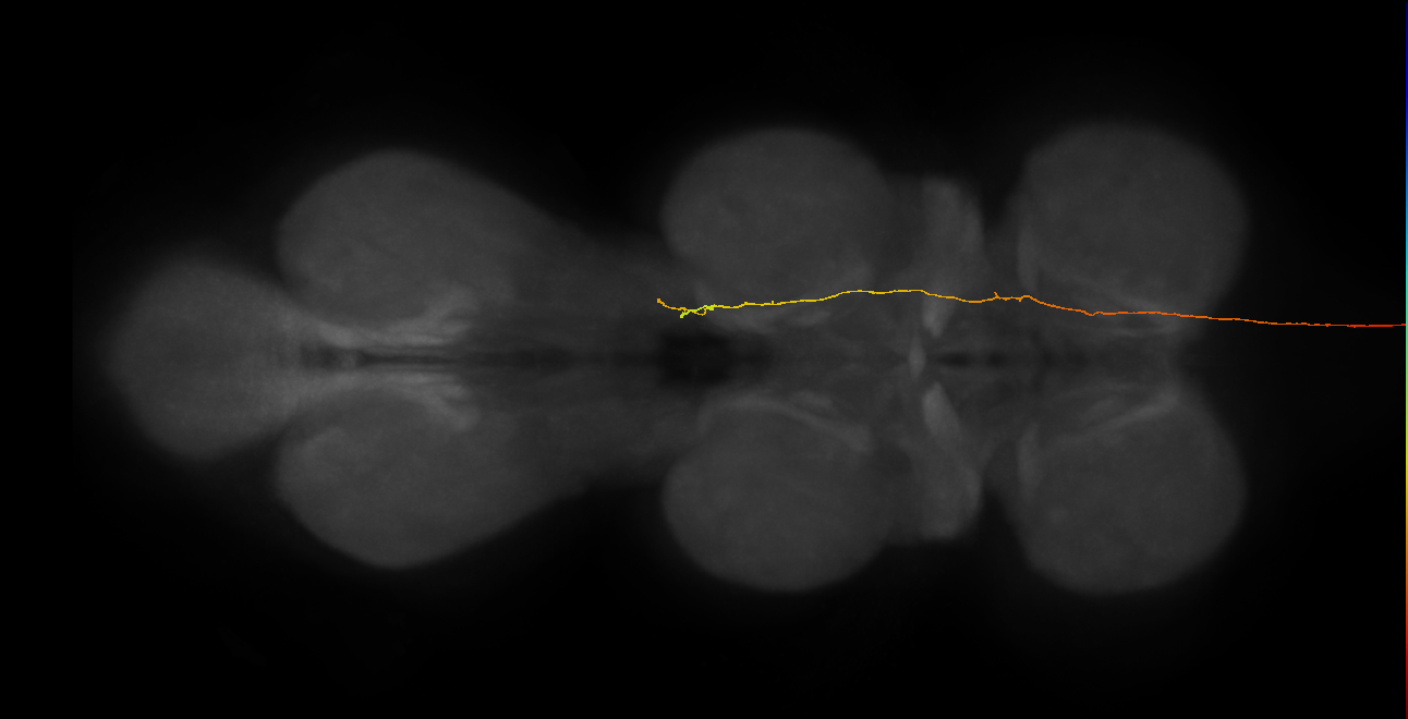 DNge115_L (MaleCNS:26464)