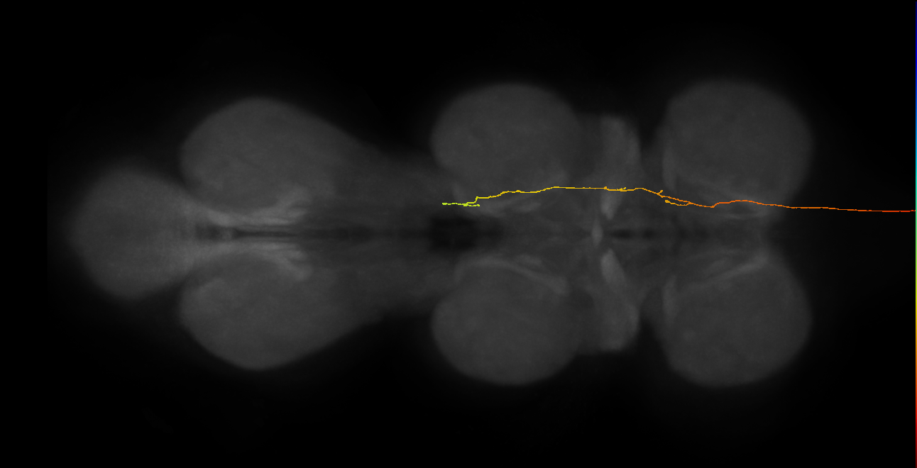 DNge115_L (MaleCNS:28687)