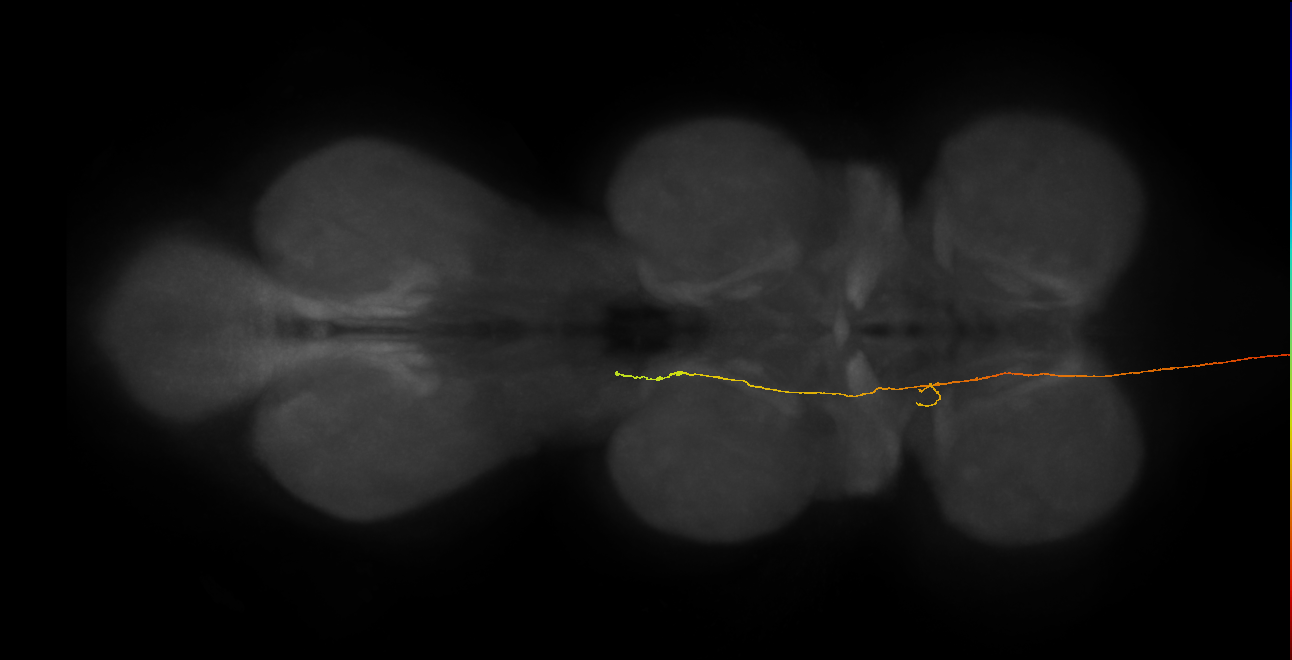 DNge115_R (MaleCNS:33683)