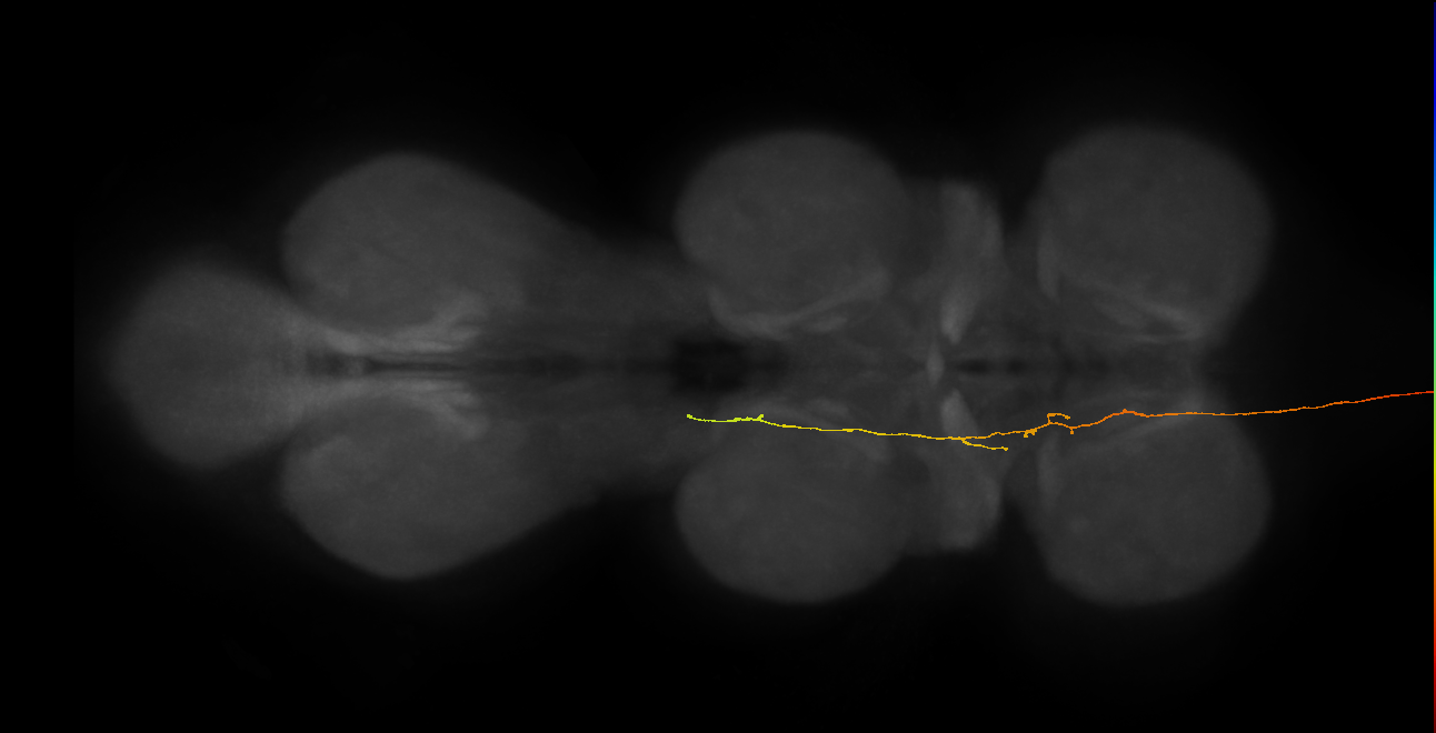 DNge115_R (MaleCNS:31769)