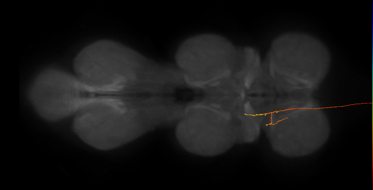 DNge117_R (MaleCNS:151406)