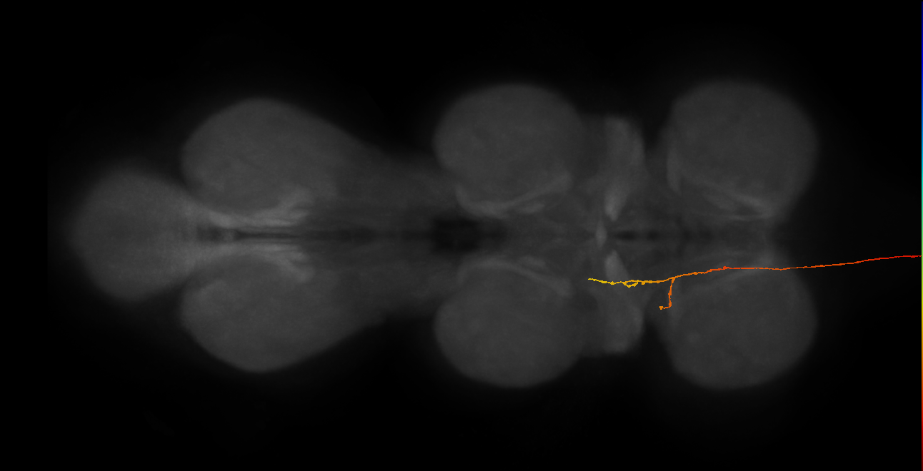 DNge117_R (MaleCNS:24666)