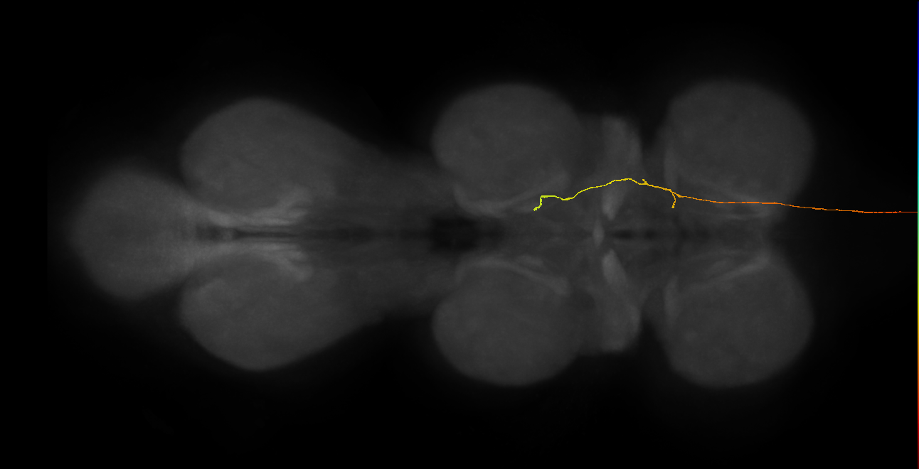 DNge126_L (MaleCNS:39014)