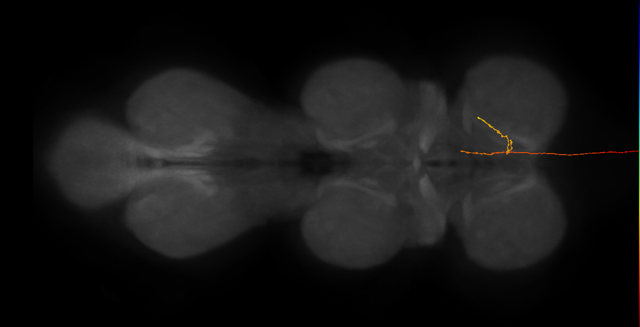 DNge134_L (MaleCNS:30465)