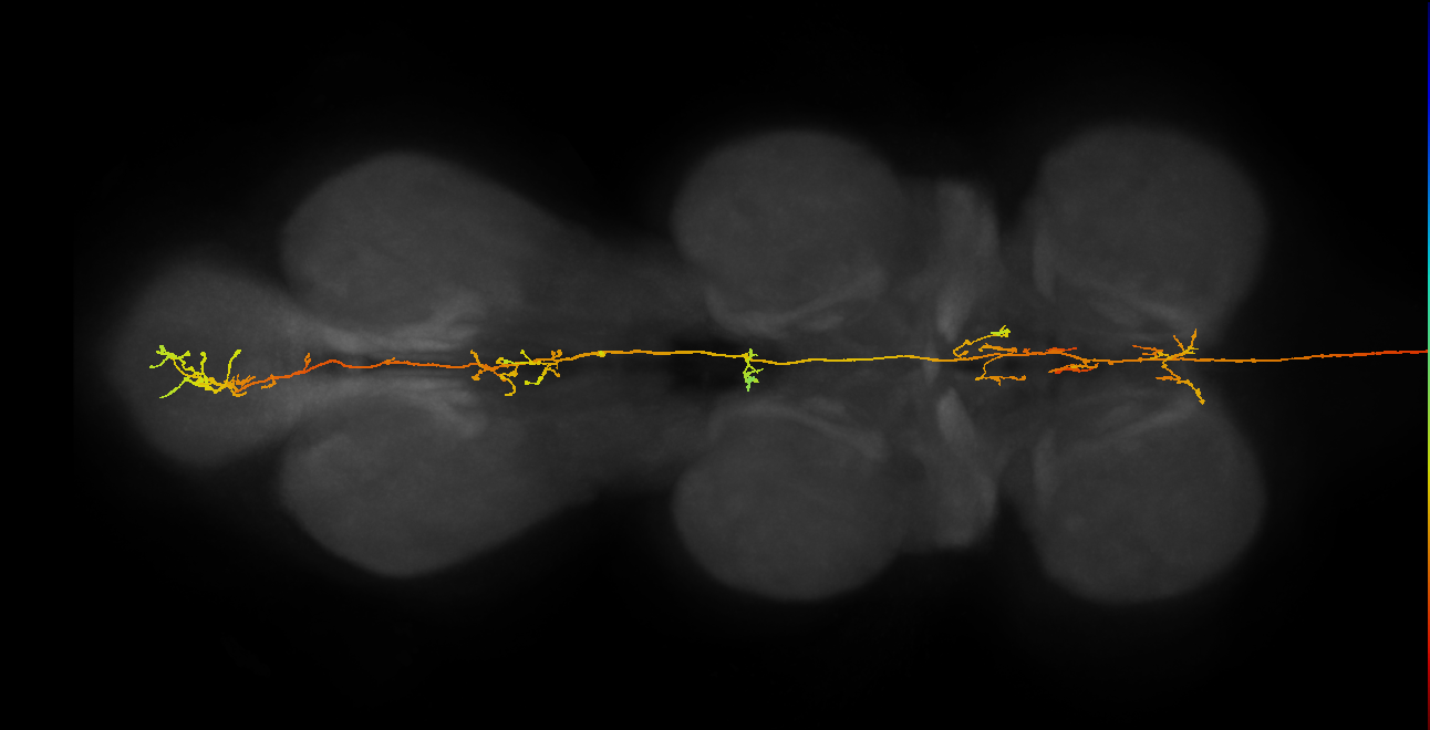 DNge139_L (MaleCNS:13857)