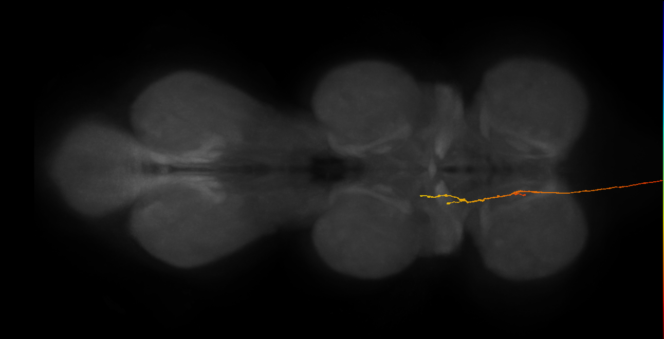 DNge145_R (MaleCNS:16118)