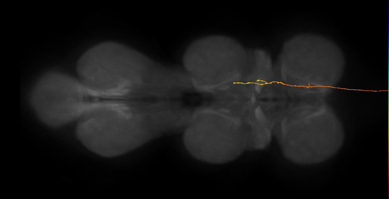 DNge145_L (MaleCNS:15485)