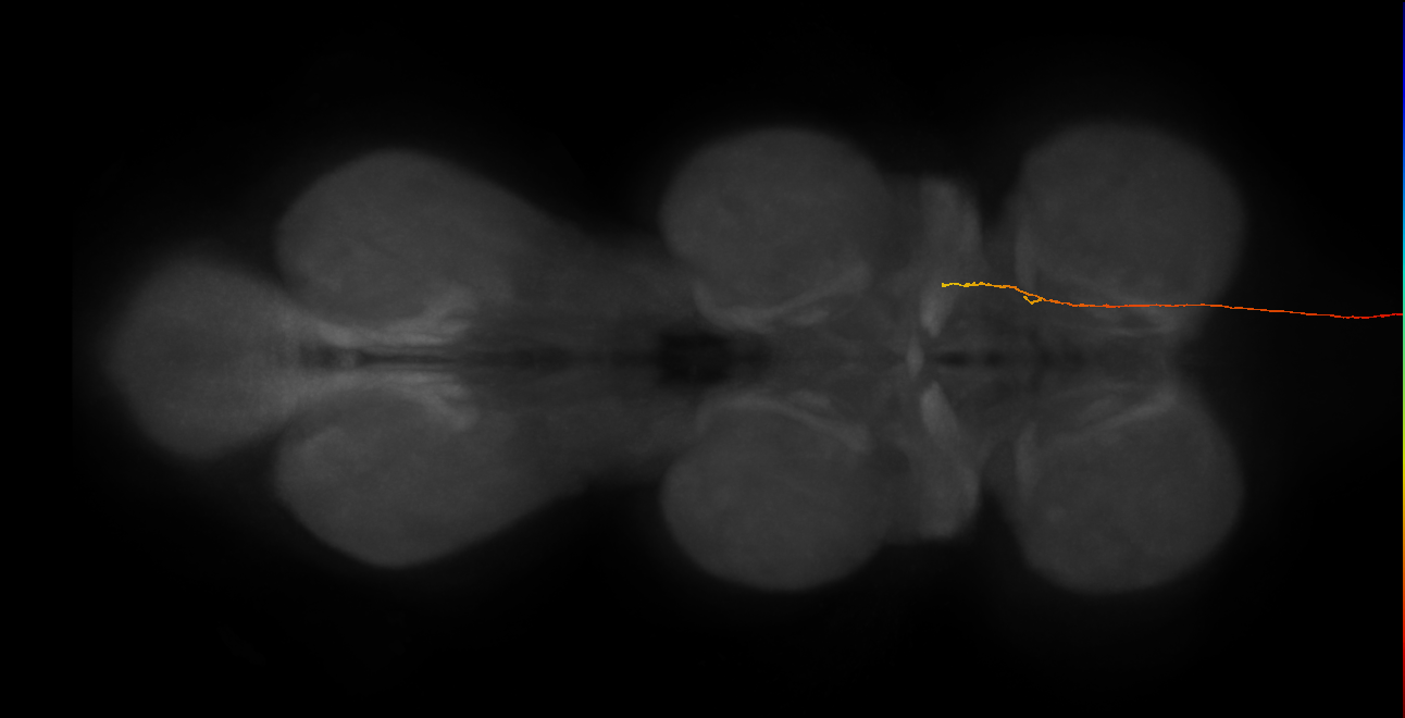 DNge179_L (MaleCNS:38731)