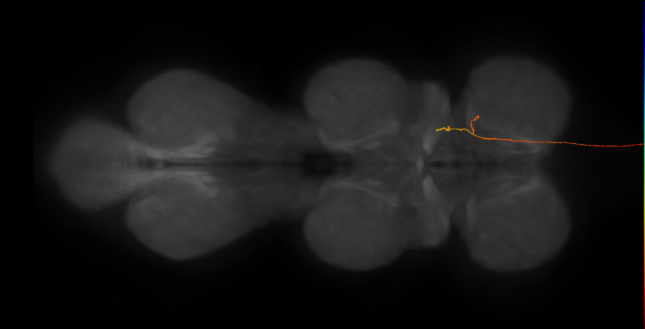 DNge179_L (MaleCNS:34649)