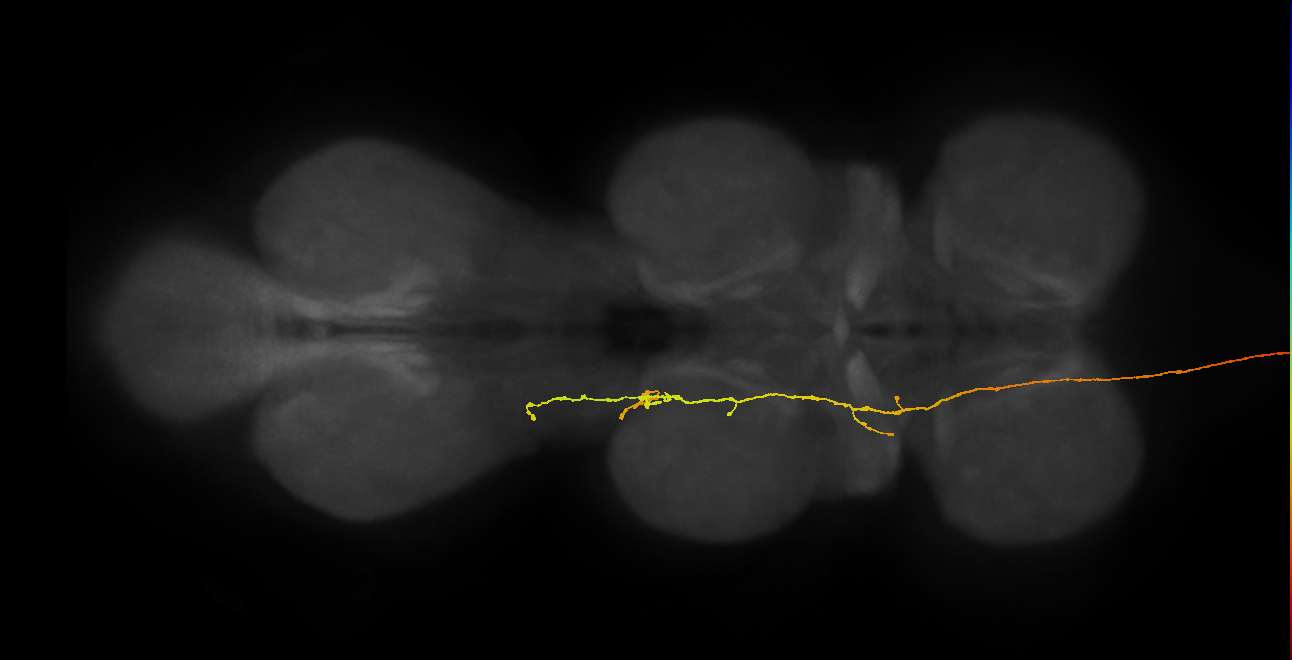DNge181_R (MaleCNS:16078)