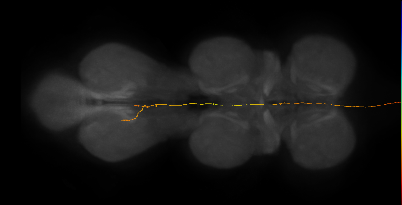DNp101(CL334)_R (MaleCNS:11182)