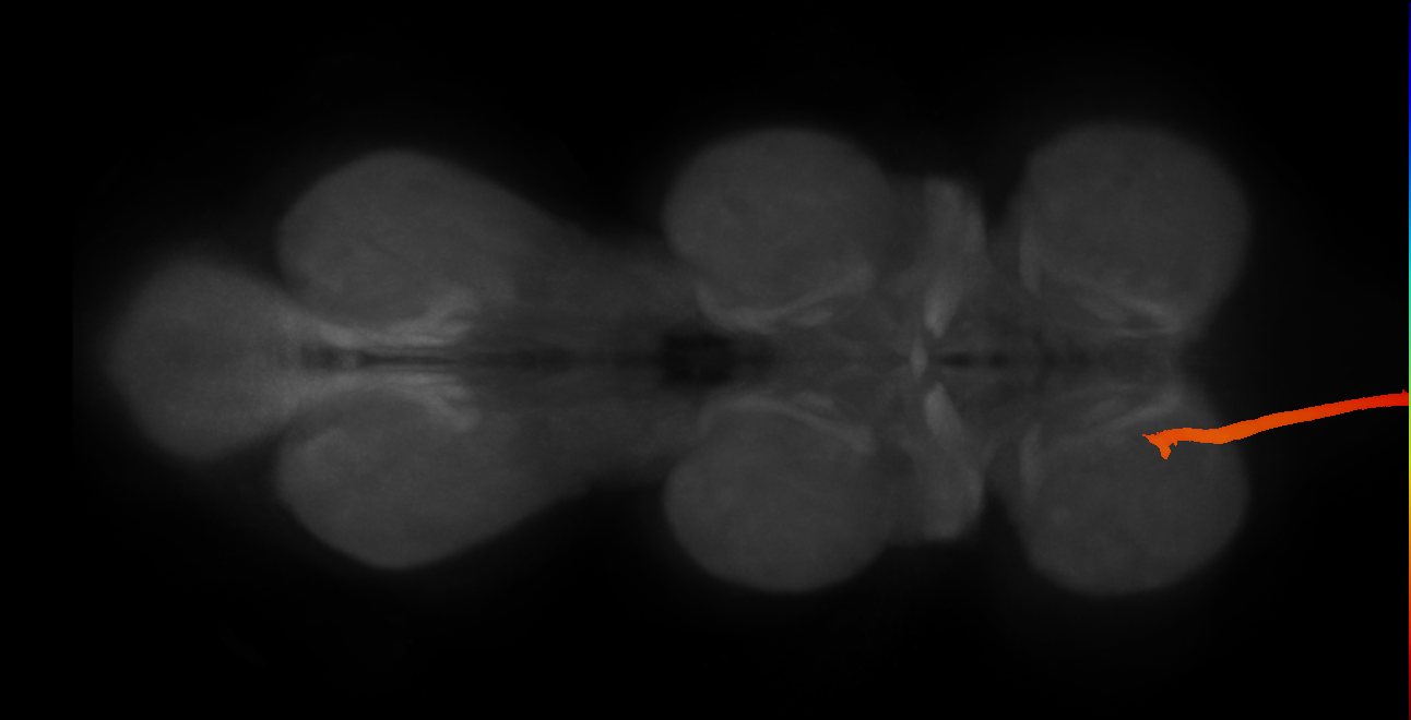 DNp20_L (MaleCNS:10162)