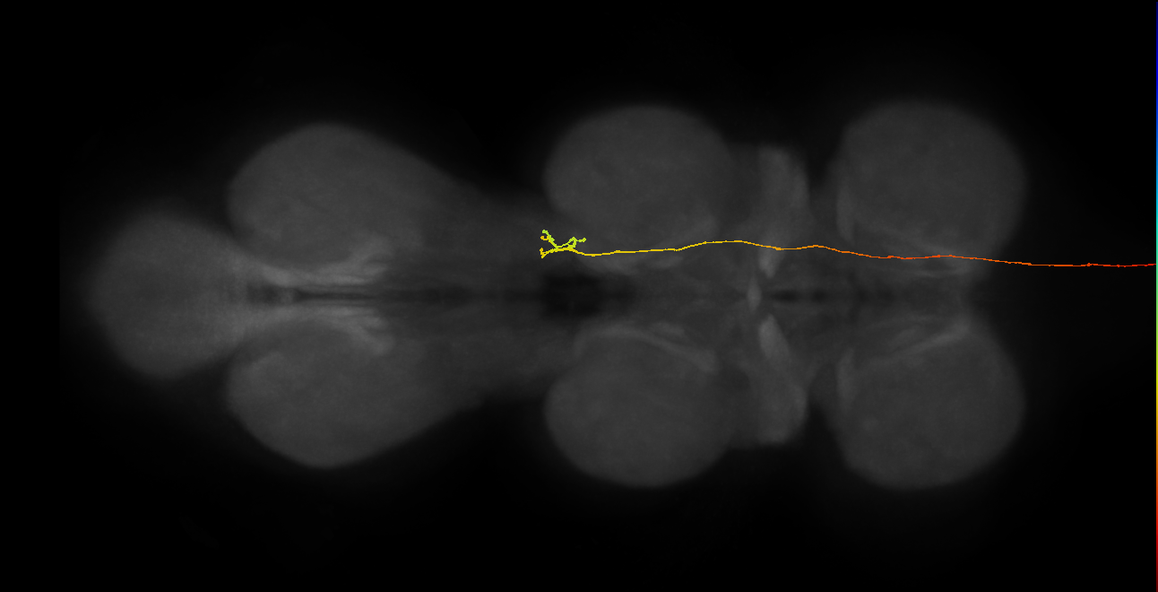 DNpe008(PS225)_R (MaleCNS:32263)