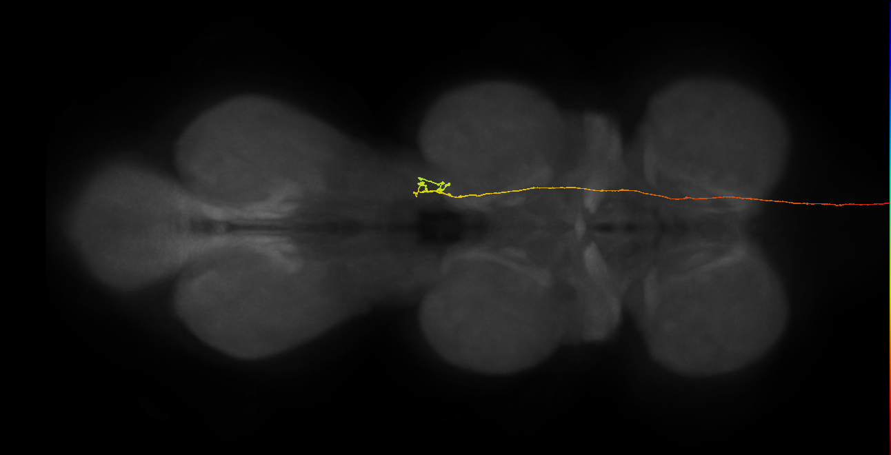 DNpe008(PS225)_R (MaleCNS:32961)