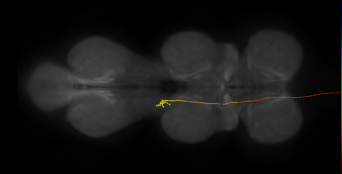 DNpe008(PS225)_L (MaleCNS:37212)