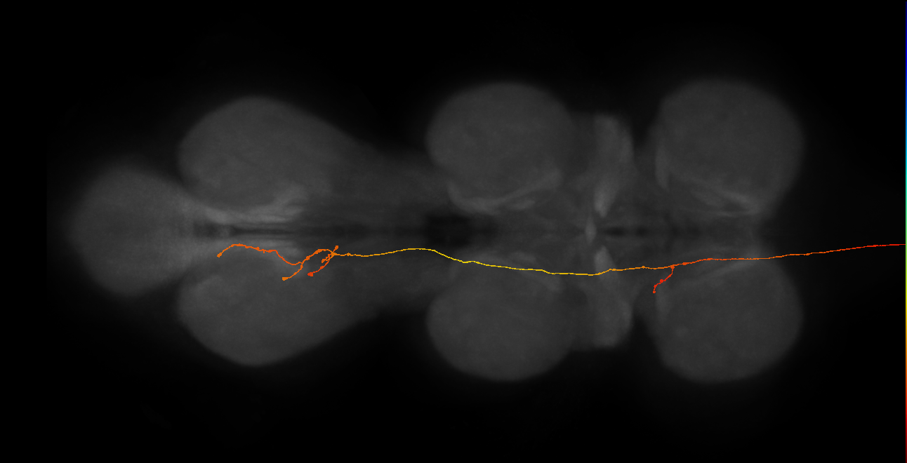 DNpe011(PS227)_L (MaleCNS:56057)