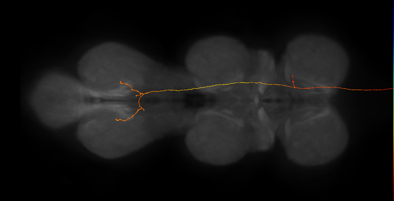 DNpe011(PS227)_R (MaleCNS:99955)