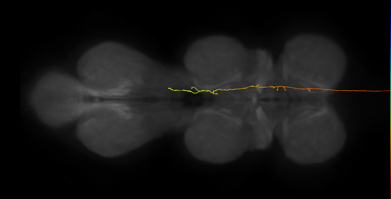 DNpe012_a(PS221)_R (MaleCNS:32166)
