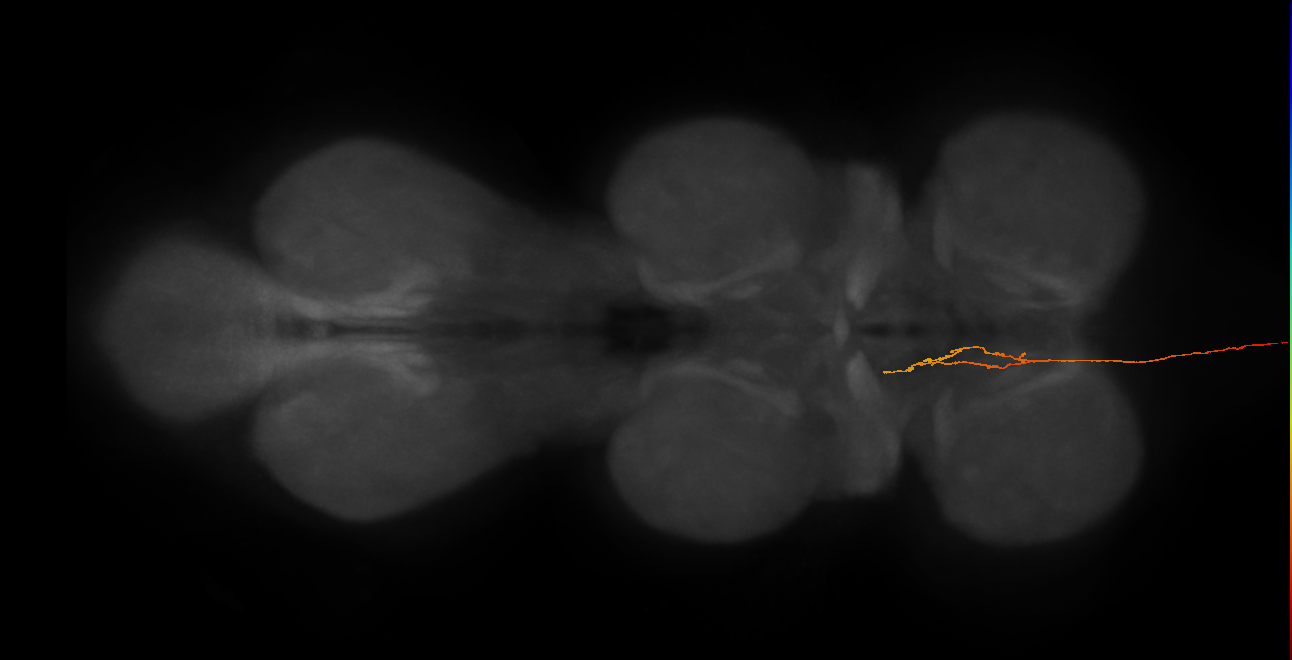 DNpe012_a(PS227)_L (MaleCNS:29934)