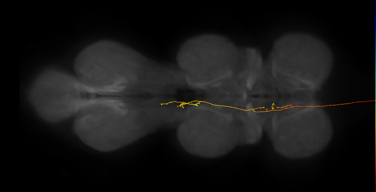 DNpe012_b(PS227)_L (MaleCNS:24987)