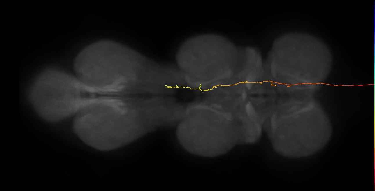 DNpe012_b(DNp16)_R (MaleCNS:22158)