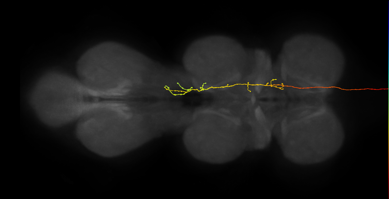DNpe014_R (MaleCNS:15667)