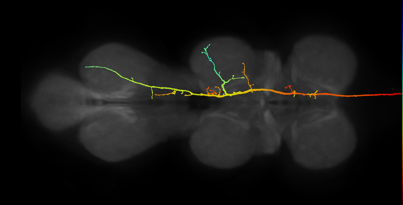 DNpe017(hb1406000196)_R (MaleCNS:555871)