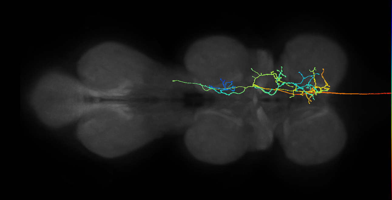 DNpe025(PVLP145)_R (MaleCNS:10601)