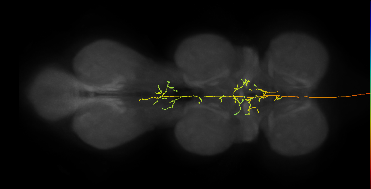 DNpe026(CL202)_R (MaleCNS:13815)